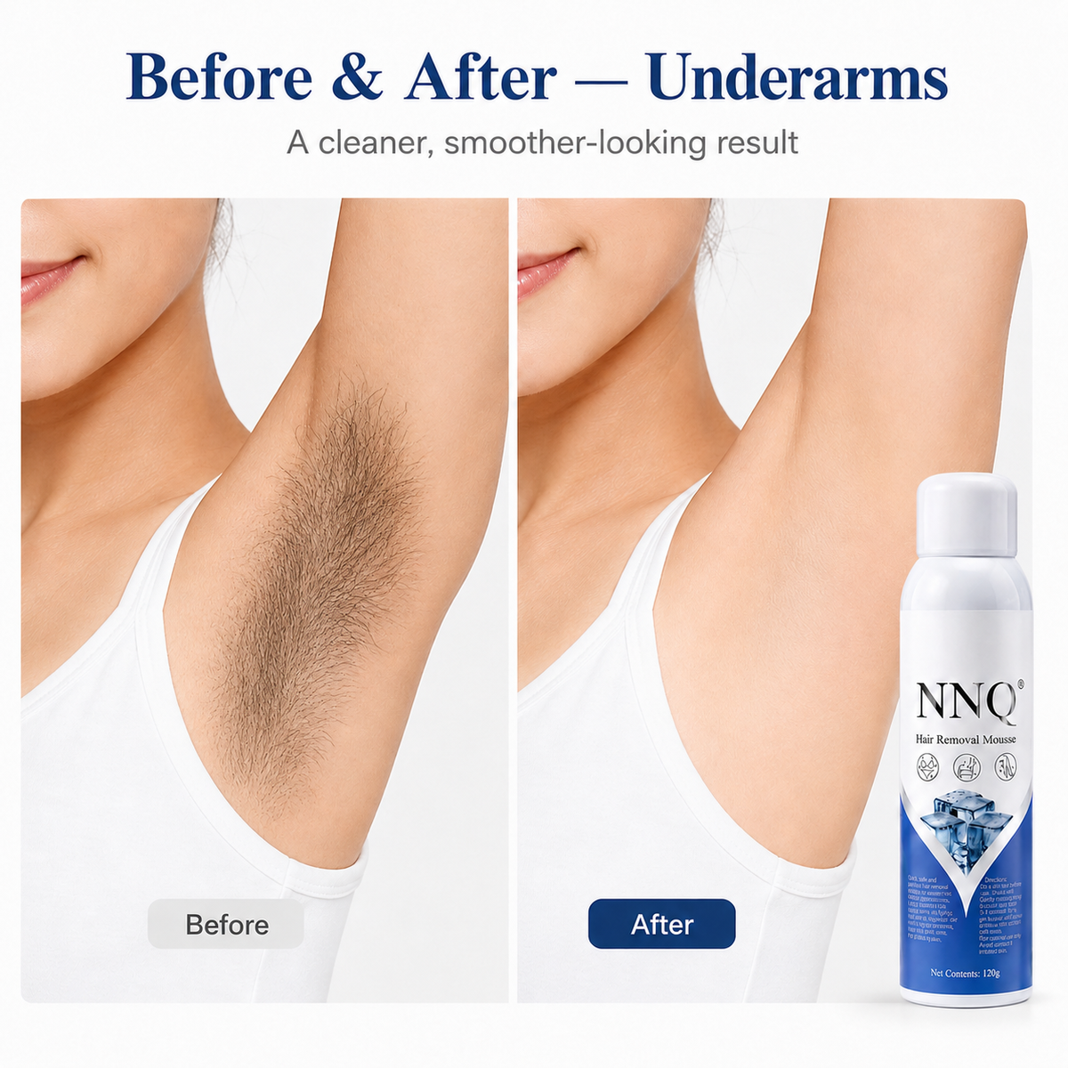 NNQ Hair Removal Spray for Men & Women +( Free Surprise  Gift Inside )