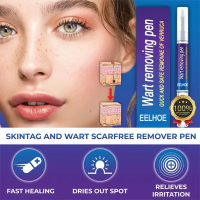 Advanced Herbal Wart Skin Tags Remover